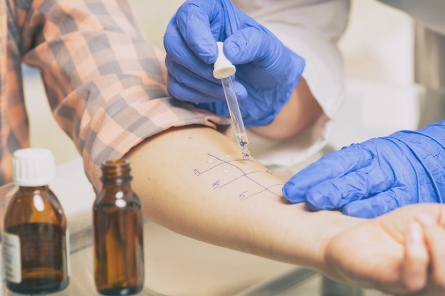 Allergy tests in laboratory